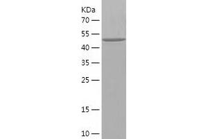 Western Blotting (WB) image for Transketolase (TKT) (AA 5-264) protein (His-IF2DI Tag) (ABIN7125467) (TKT Protein (AA 5-264) (His-IF2DI Tag))