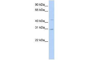 WB Suggested Anti-SLC10A4 Antibody Titration:  0. (SLC10A4 antibody  (N-Term))