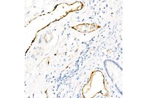 Immunohistochemistry of paraffin-embedded Human colon using von Willebrand factor (VWF) antibody (ABIN7271339) at dilution of 1:800 (40x lens). (VWF antibody)
