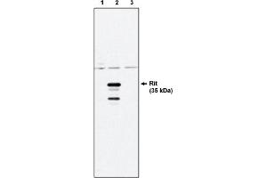 Western Blotting (WB) image for anti-Ras-Like Without CAAX 1 (RIT1) antibody (ABIN264412) (RIT1 antibody)