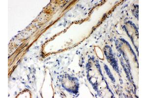 Immunohistochemistry (IHC) image for anti-NF-kappa-B inhibitor beta (NFKBIB) (AA 56-237) antibody (ABIN3043567)