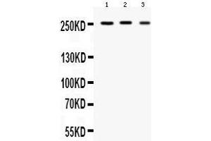 Western blot analysis of Scn1a expression in rat brain extract (lane 1), mouse brain extract (lane 2) and U87 whole cell lysates (lane 4). (SCN1A antibody  (C-Term))