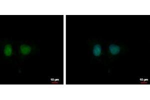 ICC/IF Image DDI1 antibody [N1C3] detects DDI1 protein at nucleus by immunofluorescent analysis. (DDI1 antibody  (Center))