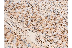 Immunohistochemistry (IHC) image for anti-Eukaryotic Translation Initiation Factor 2 Subunit 1 (EIF2S1) (pSer51) antibody (ABIN6255389)