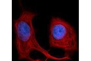 Immunofluorescence (IF) image for anti-Keratin 18 (KRT18) antibody (Alexa Fluor 594) (ABIN2656840) (Cytokeratin 18 antibody  (Alexa Fluor 594))
