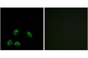 Immunofluorescence analysis of MCF7 cells, using GPR103 Antibody. (QRFPR antibody  (AA 271-320))