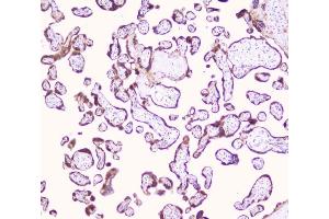 IHC analysis of LRTOMT using anti-LRTOMT antibody (ABIN7602986). (Leucine Rich Transmembrane and 0-Methyltransferase Domain Containing (LRTOMT) (Middle Region) antibody)