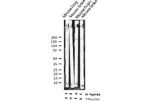 Western blot analysis of Phospho-PPAR-BP (Thr1457) expression in various lysates (MED1 antibody  (pThr1457))