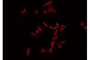 ABIN6266870 staining Hela by IF/ICC. (MAST2 antibody  (Internal Region))