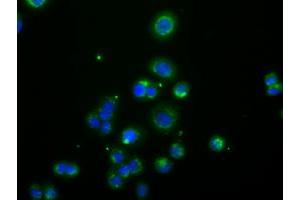 Image no. 3 for anti-Acetyl-CoA Acetyltransferase 2 (ACAT2) antibody (ABIN1496397) (ACAT2 antibody)
