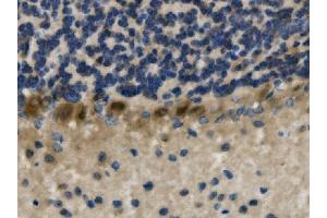 IHC analysis of LHX1 using anti-LHX1 antibody (ABIN7599263).