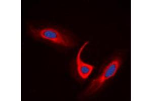 Immunofluorescent analysis of ACOT4 staining in A549 cells. (ACOT4 antibody  (C-Term))