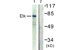 Immunohistochemistry analysis of paraffin-embedded human skin tissue using ETK (Ab-40) antibody. (BMX antibody)