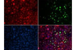 Immunofluorescence analysis of U20S cell using RAD18 antibody. (RAD18 antibody)