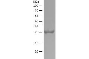 Western Blotting (WB) image for tau Protein (AA 200-380) protein (His tag) (ABIN7125322) (tau Protein (AA 200-380) (His tag))