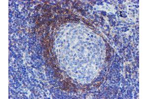 Immunohistochemical staining of paraffin-embedded Human tonsil using anti-SERPINA5 mouse monoclonal antibody.