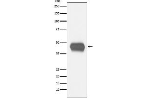 Western blot analysis of CD1a expression in human fetal thymus lysate.