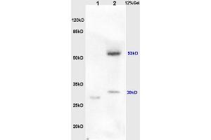L1 rat lung, L2 human colon carcinoma lysates probed (ABIN730483) at 1:200 in 4 °C. (BPIFB1 antibody  (AA 21-120))