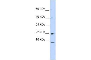 WB Suggested Anti-NDUFC2 Antibody Titration:  0. (NDUFC2 antibody  (N-Term))