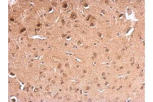 IHC-P Image GAD67 antibody detects GAD67 protein at on mouse fore brain by immunohistochemical analysis. (GAD antibody  (N-Term))