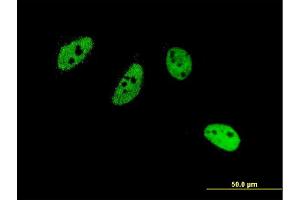 Immunofluorescence of monoclonal antibody to CREM on HeLa cell. (CREM antibody  (AA 201-300))