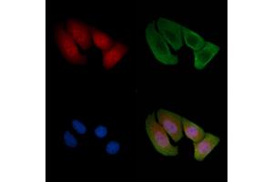 ABIN6255653 and ABIN6268976 staining Hela cells(30 min of UV treatment) by IF/ICC.