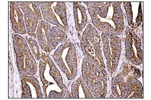 IHC analysis of HCCS using anti-HCCS antibody (ABIN7602424). (HCCS antibody  (AA 76-268))