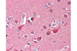 Anti-TF / Transferrin antibody IHC of human brain, cortex. (Transferrin antibody)