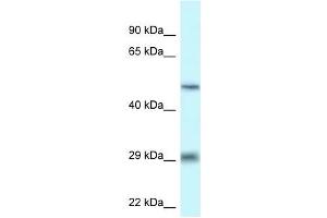 Western Blot showing LIPH antibody used at a concentration of 1 ug/ml against THP-1 Cell Lysate (LIPH antibody  (C-Term))