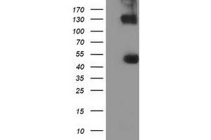 HEK293T cells were transfected with the pCMV6-ENTRY control (Left lane) or pCMV6-ENTRY UHMK1 (Right lane) cDNA for 48 hrs and lysed. (UHMK1 antibody)