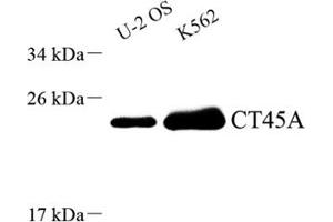 Western blot analysis of CT45A (ABIN7073596),at dilution of 1: 1500 (CT45A10 antibody)