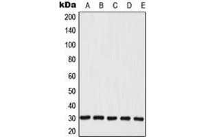 Western blot analysis of MRPL28 expression in JAR (A), MCF7 (B), A549 (C), Raw264. (MRPL28 antibody  (Center))