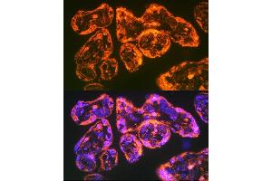 Immunofluorescence analysis of Human placenta using Integrin alpha 5 (ITG/CD49e) antibody (ABIN6131552, ABIN6142564, ABIN6142565 and ABIN6221799) at dilution of 1:100. (ITGA5 antibody  (AA 750-1000))