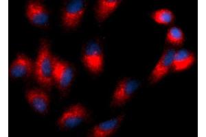 Immunofluorescence (IF) image for anti-Tetraspanin 26 (TSPAN26) (AA 112-241) antibody (PE) (ABIN5566698) (CD37 antibody  (AA 112-241) (PE))