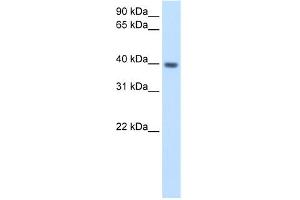 WB Suggested Anti-ITGB1BP2 Antibody Titration:  2.