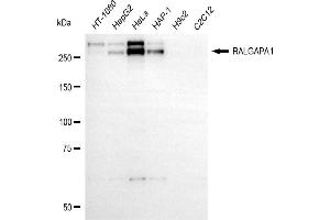Western blotting analysis using RALGAPA1 antibody (ABIN7800124).