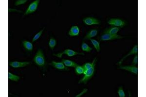 Immunofluorescent analysis of Hela cells using ABIN7163658 at dilution of 1:100 and Alexa Fluor 488-congugated AffiniPure Goat Anti-Rabbit IgG(H+L) (PLEKHO1 antibody  (AA 143-404))