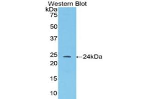 Western Blotting (WB) image for anti-Angiopoietin 1 (ANGPT1) (AA 35-231) antibody (ABIN1857990) (Angiopoietin 1 antibody  (AA 35-231))