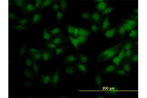 Immunofluorescence of monoclonal antibody to SCAND2 on HeLa cell. (SCAND2 antibody  (AA 1-62))