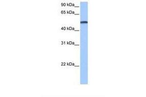 Image no. 1 for anti-Cytochrome P450, Family 1, Subfamily B, Polypeptide 1 (CYP1B1) (AA 200-249) antibody (ABIN6738781) (CYP1B1 antibody  (AA 200-249))