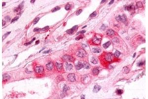 Anti-PTGER3 / EP3 antibody  ABIN1049256 IHC staining of human kidney, renal tubules. (PTGER3 antibody  (Cytoplasmic Domain))