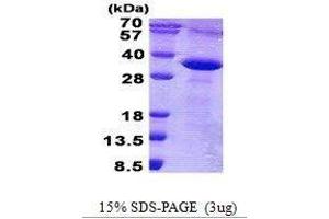 Figure annotation denotes ug of protein loaded and % gel used. (TACSTD2 Protein)