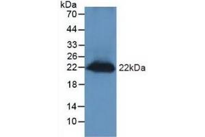 Detection of REG3g in Mouse Testis Tissue using Polyclonal Antibody to Regenerating Islet Derived Protein 3 Gamma (REG3g) (REG3g antibody  (AA 45-152))