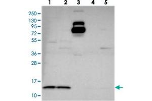 Western blot analysis of Lane 1: RT-4, Lane 2: U-251 MG, Lane 3: Human Plasma, Lane 4: Liver, Lane 5: Tonsil with CHCHD1 polyclonal antibody  at 1:250-1:500 dilution. (CHCHD1 antibody)