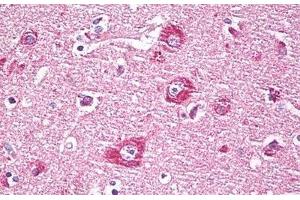 Anti-DACT1 / DAPPER antibody IHC staining of human brain, cortex neurons. (DACT1 antibody  (AA 725-775))