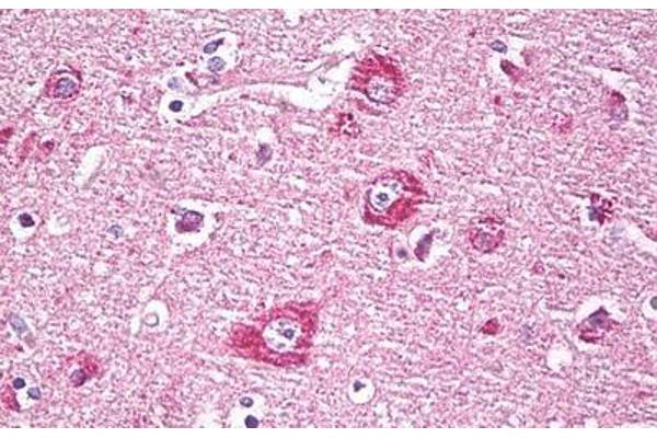DACT1 antibody  (AA 725-775)