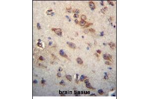 CK Antibody (C-term) (ABIN656313 and ABIN2845615) immunohistochemistry analysis in formalin fixed and paraffin embedded human brain tissue followed by peroxidase conjugation of the secondary antibody and DAB staining.