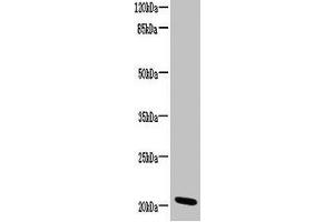 Western blot All lanes: CCDC32 antibody at 2 μg/mL + HL60 whole cell lysate Secondary Goat polyclonal to rabbit IgG at 1/10000 dilution Predicted band size: 21, 22, 16 kDa Observed band size: 21 kDa (C15ORF57 antibody  (AA 1-185))