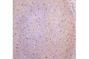 IHC testing of FFPE mouse brain tissue with WWOX antibody at 1ug/ml. (WWOX antibody)