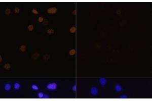 Immunofluorescence analysis of C6 cells using Acetyl-Histone H4-K16 Polyclonal Antibody at dilution of 1:100. (Histone H4 antibody  (acLys16))